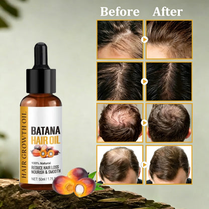 Batana Oil for Hair Growth - Batana Oil - 100% Natural