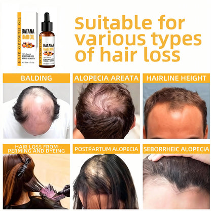 Batana Oil for Hair Growth - Batana Oil - 100% Natural