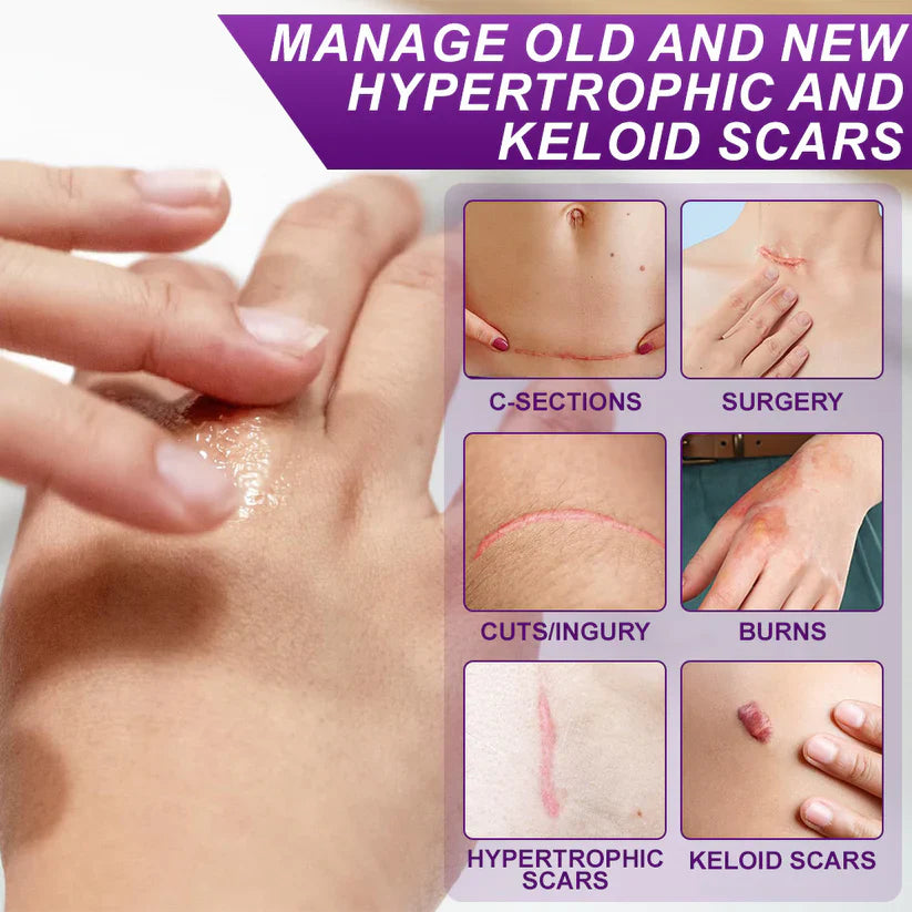 Misspone® Scar Gel – Australian Dermatology Approved for Proven Scar Repair Visible Results, Healthier Skin, Renewed Confidence