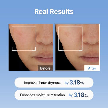 🔥Retinal Skin Booster Serum