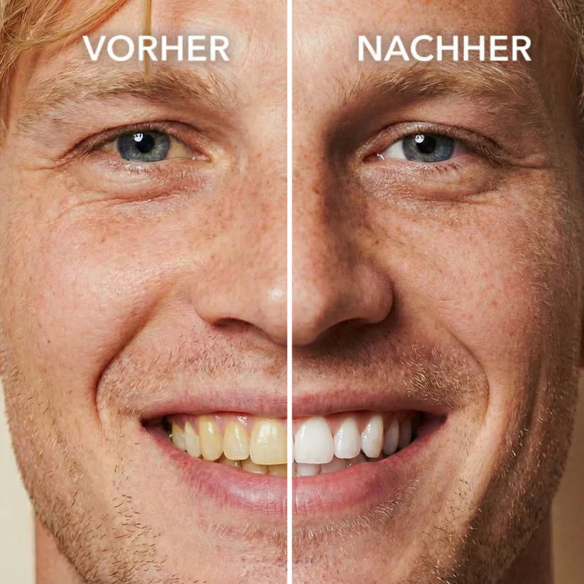 SMILEFITPRO™ Tooth Polish