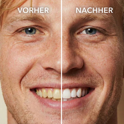 SMILEFITPRO™ Tooth Polish