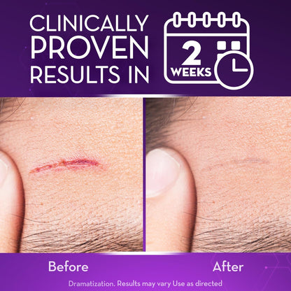 Misspone® Scar Gel – Australian Dermatology Approved for Proven Scar Repair Visible Results, Healthier Skin, Renewed Confidence