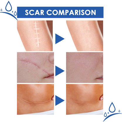 🔥Limited-time 60% sale--LOVILDS Scar Repair Cream — Smooth, Clear, Confident Skin