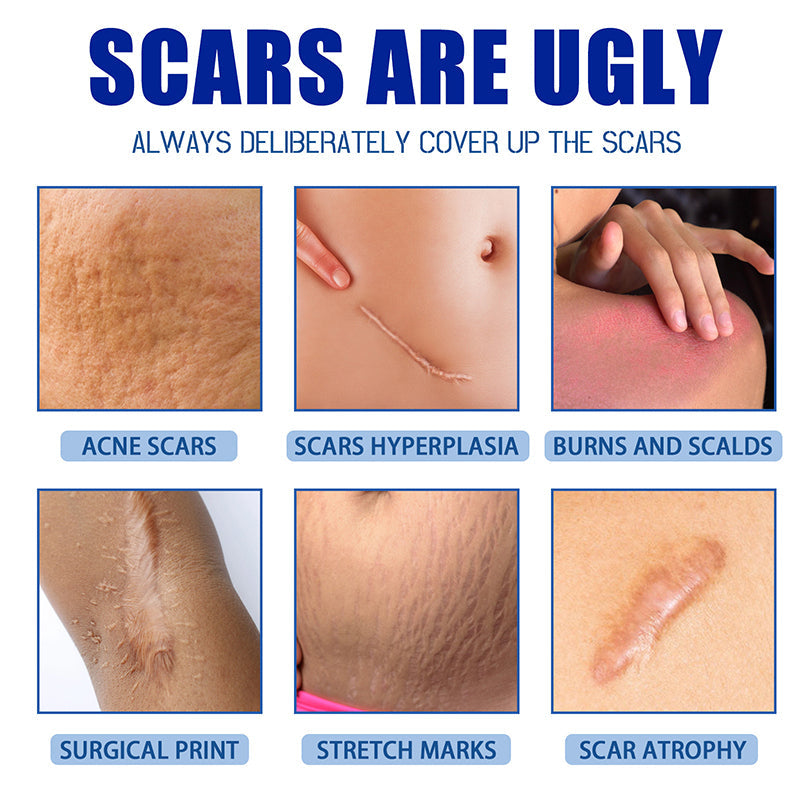 🔥Limited-time 60% sale--LOVILDS Scar Repair Cream — Smooth, Clear, Confident Skin